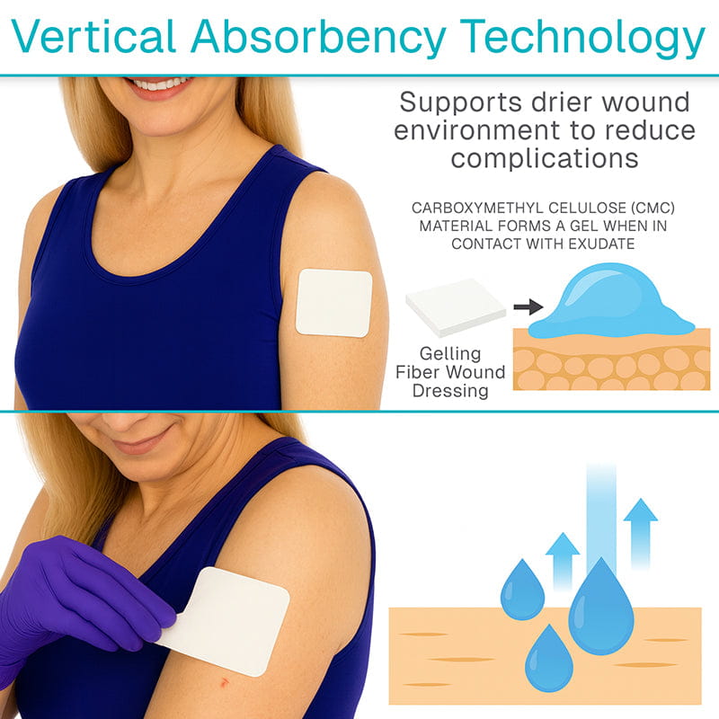 ViveCare Gelling Fiber Wound Dressing - image 2