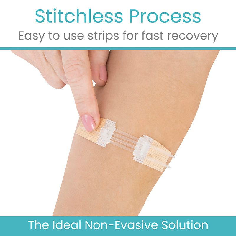 ViveCare Wound Closure Kit (Sterile) - image 5